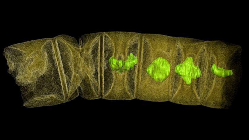 Uma imagem raio-X dos fósseis. Imagem: Stafan Bengtson